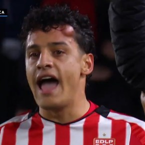 Video: el impresionante chichón que ligó Tiago Palacios en Estudiantes