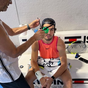 ¿Por qué Carlos Alcaraz se entrena con un cono sobre el ojo?